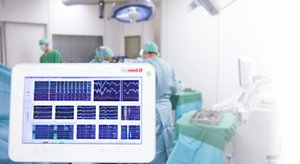Neuromonitorowanie śródoperacyjne na monitorze na sali operacyjnej